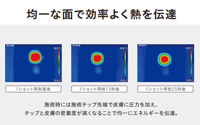 テンサーマ