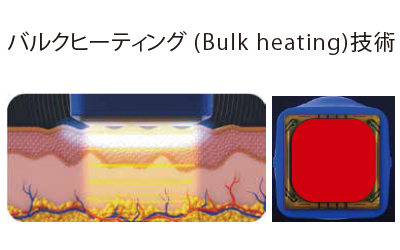 テンサーマ