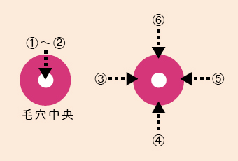 アグネス