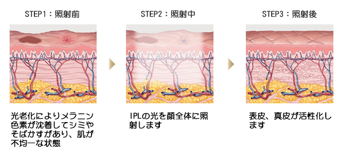 ステラM22