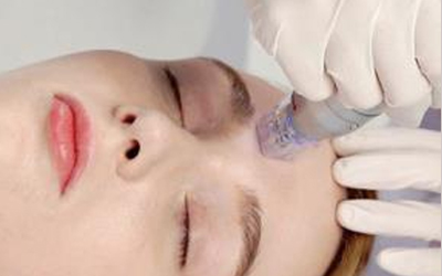 マイクロニードルRF（シルファームX）